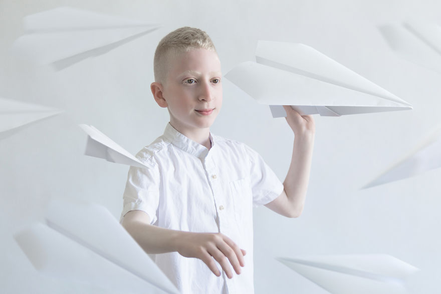 I Captured The Hypnotizing Beauty Of Albino People (Part 2) I Captured The Hypnotizing Beauty Of Albino People (Part 2)