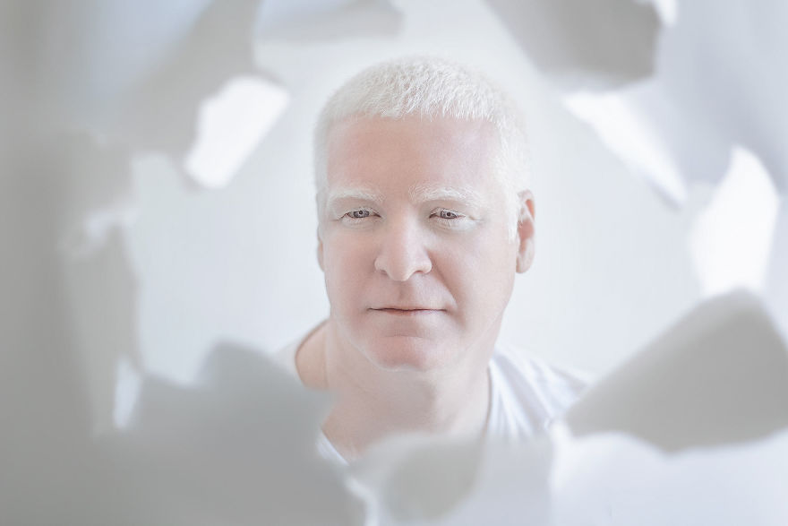 I Captured The Hypnotizing Beauty Of Albino People (Part 2) I Captured The Hypnotizing Beauty Of Albino People (Part 2)