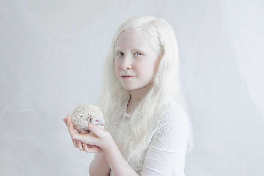 I Captured The Hypnotizing Beauty Of Albino People (Part 2)
