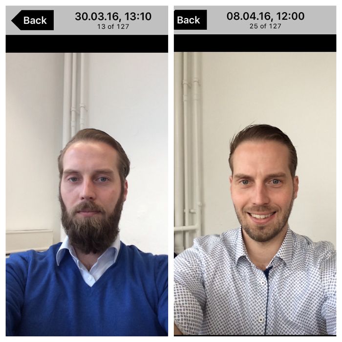 After 6 Months I Had Enough ... Grew It Back Though ;)