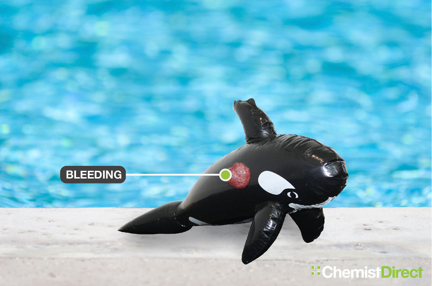 Skin Cancer On Inflatables: 8 Of The Most Common Symptoms Of Skin Cancer