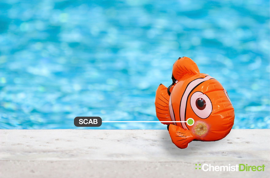 Skin Cancer On Inflatables: 8 Of The Most Common Symptoms Of Skin Cancer