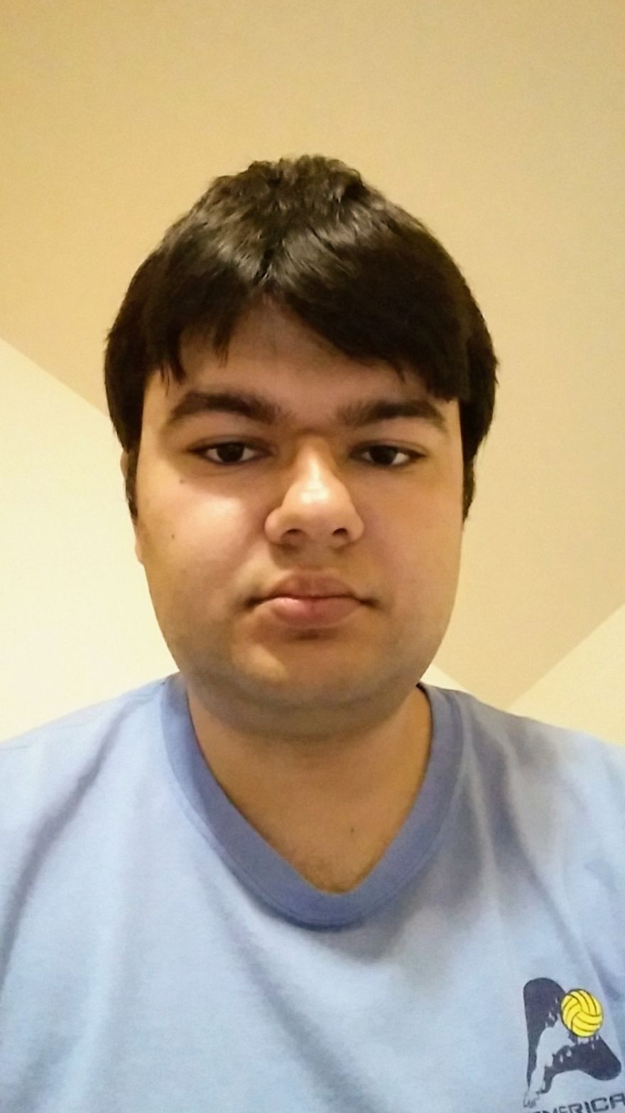 My Attempt To Become The World's First Person To Be Cured From Autism Through Plastic Surgery