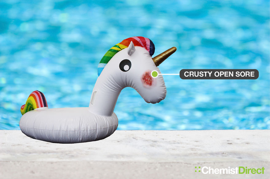 Skin Cancer On Inflatables: 8 Of The Most Common Symptoms Of Skin Cancer