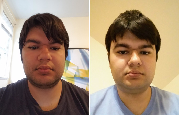 My Attempt To Become The World’s First Person To Be Cured From Autism Through Plastic Surgery