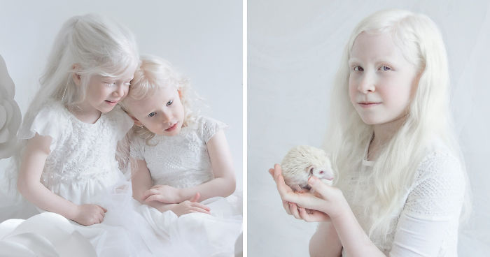 I Captured The Hypnotizing Beauty Of Albino People (Part 2)