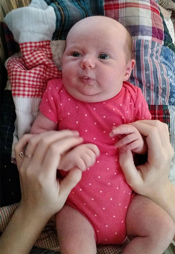 Baby Pattern Baldness