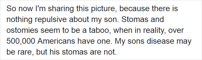 hirschsprungs-disease-jameus-dallas-lynn-4 hirschsprungs-disease-jameus-dallas-lynn-4