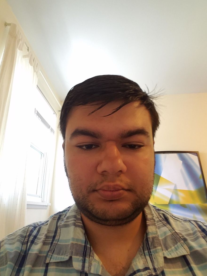 My Attempt To Become The World's First Person To Be Cured From Autism Through Plastic Surgery