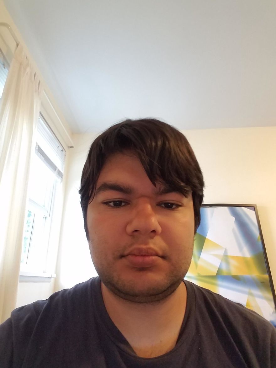 My Attempt To Become The World's First Person To Be Cured From Autism Through Plastic Surgery My Attempt To Become The World's First Person To Be Cured From Autism Through Plastic Surgery