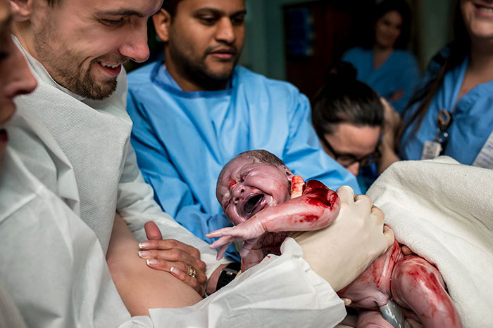 Pregnancy-giving-birth-fathers-participating-delivery-room