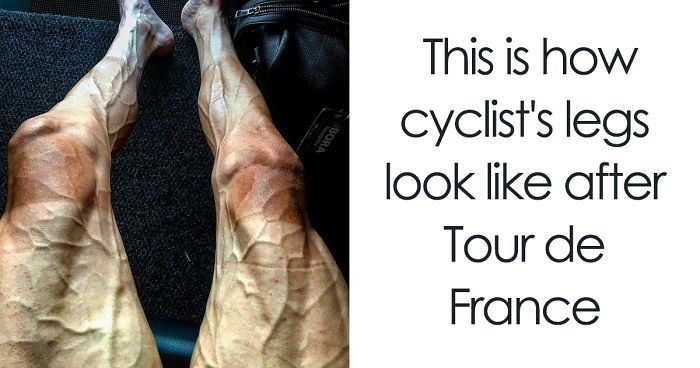 73 Rare Photos Reveal The Unseen Side Of Things, And It Will Change The Way You See The World