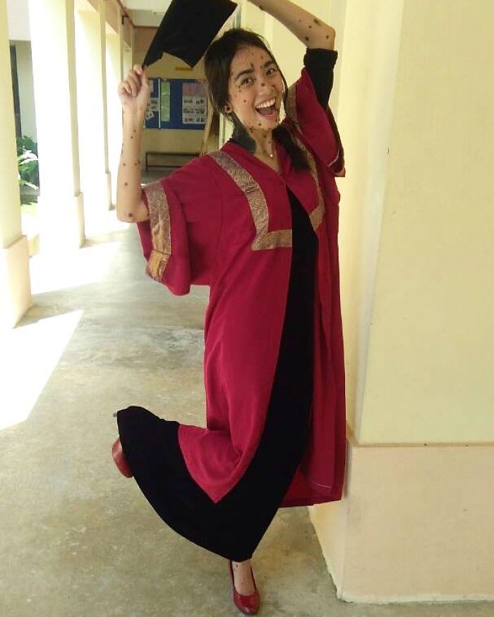 Woman Who Was Called A Monster For Her Head-To-Toe Hairy Moles Might Be The Next Miss Universe Woman Who Was Called A Monster For Her Head-To-Toe Hairy Moles Might Be The Next Miss Universe