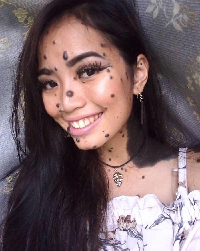 Woman Who Was Called A Monster For Her Head-To-Toe Hairy Moles Might Be The Next Miss Universe Woman Who Was Called A Monster For Her Head-To-Toe Hairy Moles Might Be The Next Miss Universe