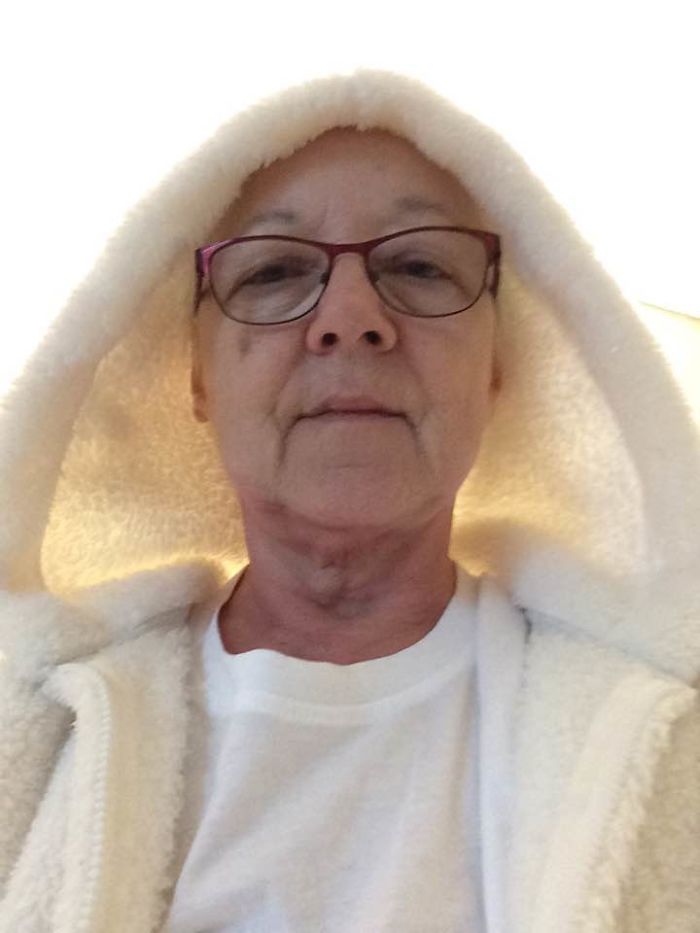 Loss My Blond Hair Due To Breast Cancer. Its Now Coming In Dark And Light Greys With White