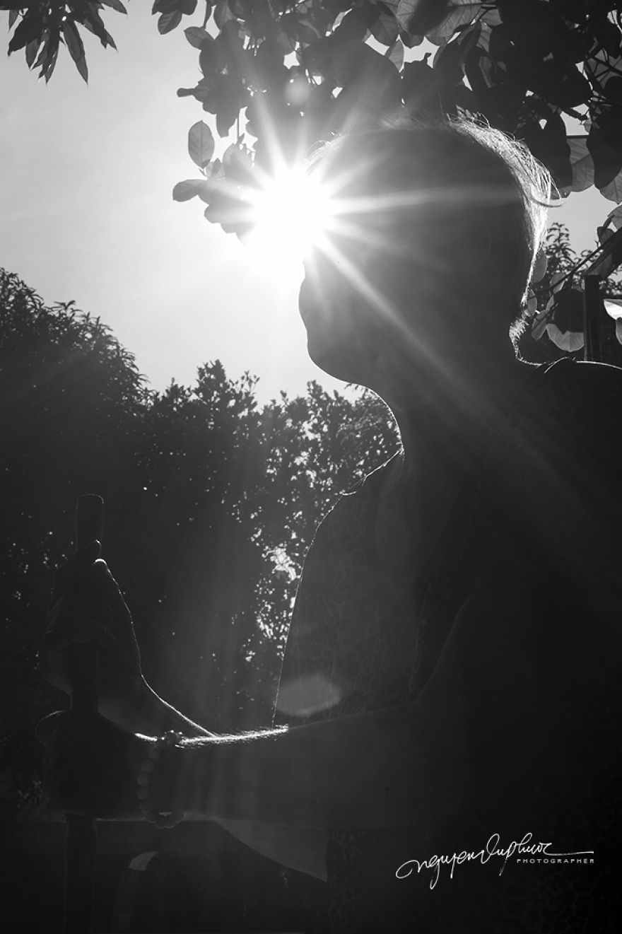 More Brutal Than Death Reality Of Acid Burn Victims Of Vietnam