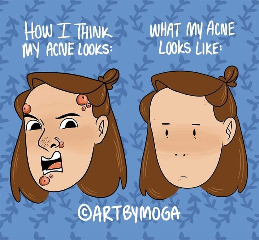 Acne, Amiright?