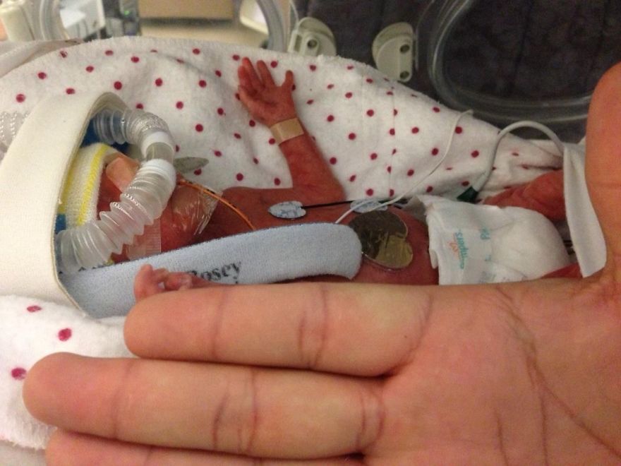 How The Biggest Miracle Came In The Tiniest Package