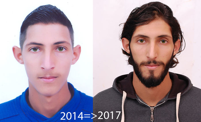 3 Years Transformation .. Get Beard And A Long Hair