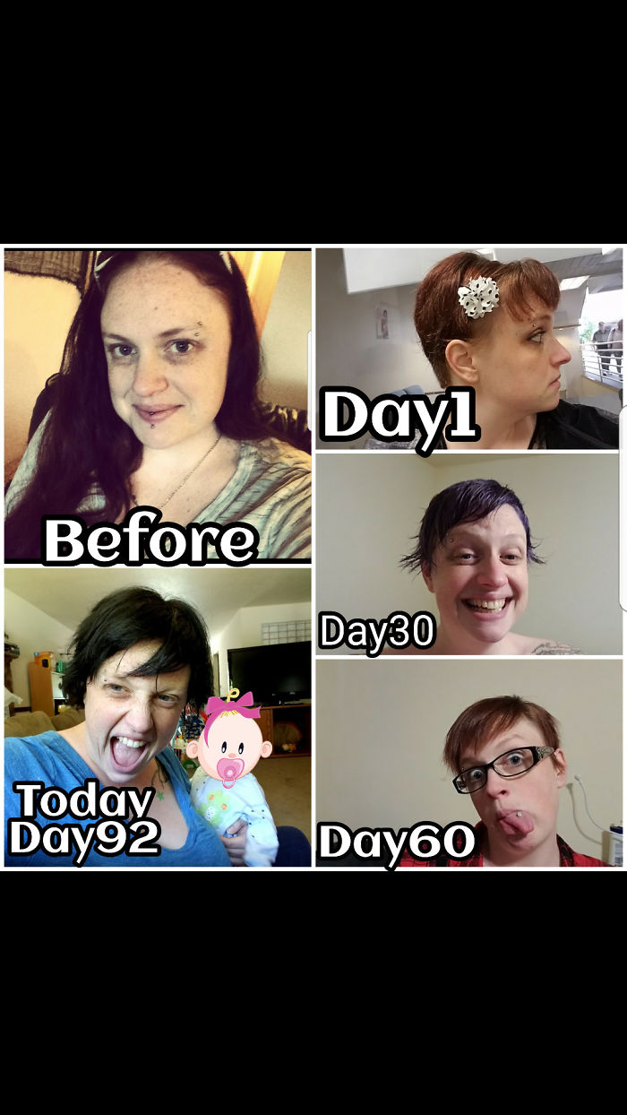 A Few Months Postpartum My Hair Loss Was Just Too Much