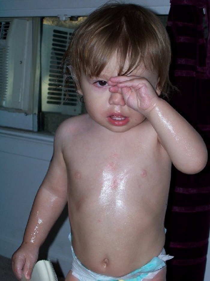 Vaseline.....now Imagine How Difficult It Was To Carry Him Up To The Bathtub!