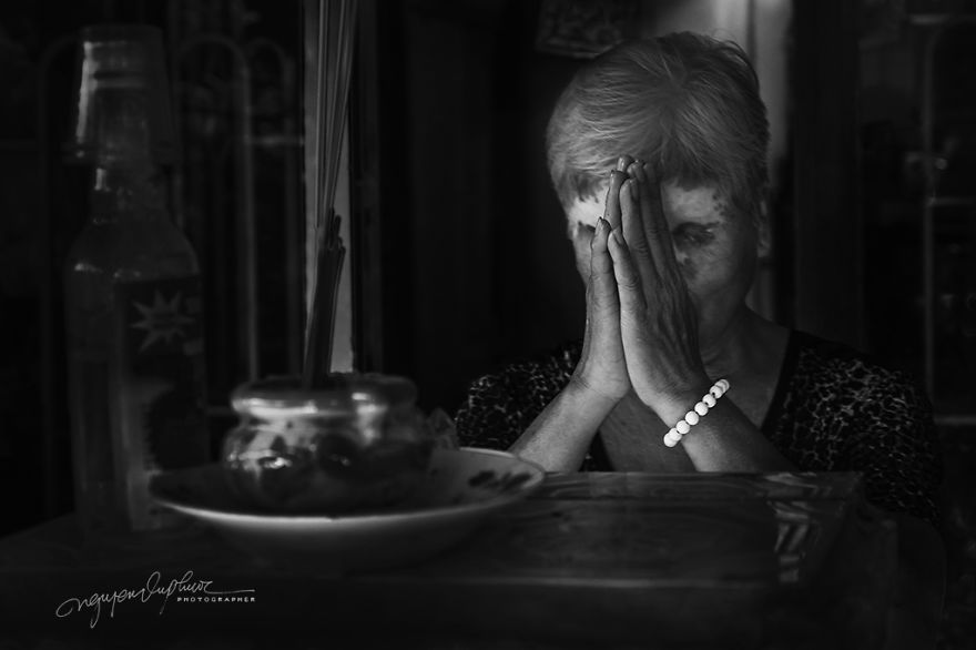 More Brutal Than Death Reality Of Acid Burn Victims Of Vietnam