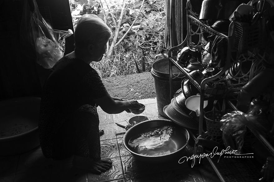 More Brutal Than Death Reality Of Acid Burn Victims Of Vietnam