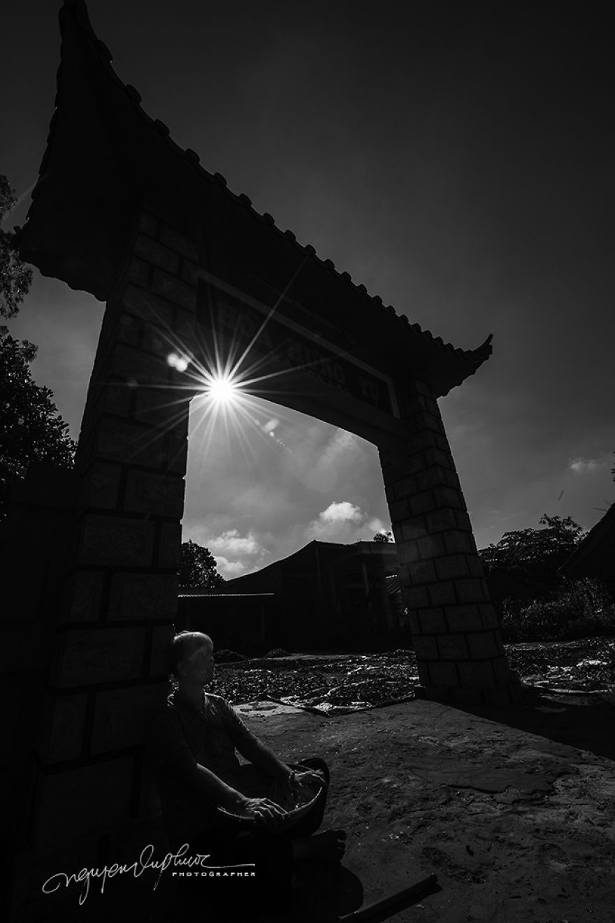 More Brutal Than Death Reality Of Acid Burn Victims Of Vietnam