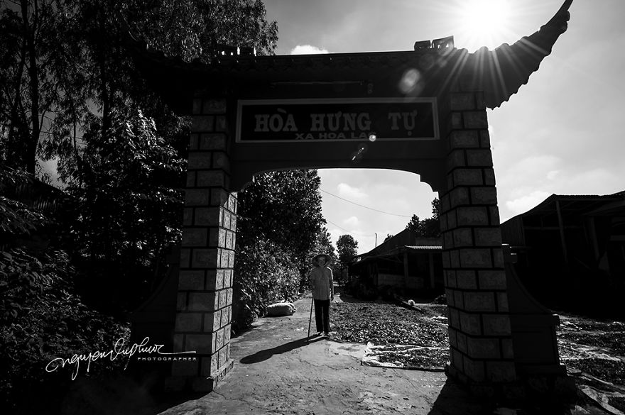 More Brutal Than Death Reality Of Acid Burn Victims Of Vietnam