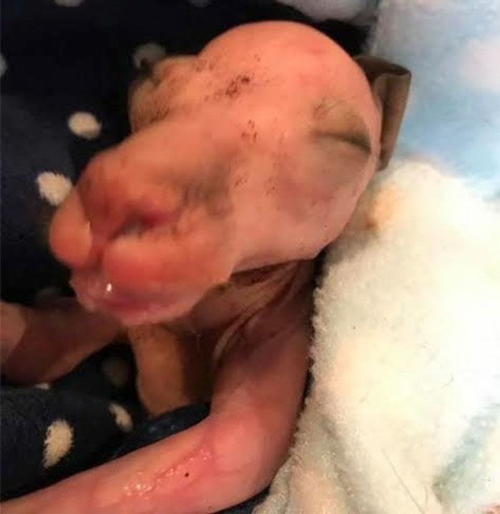 baby-kangaroo-pouch-tiny-hand-car-accident-dawson-australia-11 baby-kangaroo-pouch-tiny-hand-car-accident-dawson-australia-11