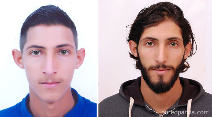 3 Years Transformation. Get Beard And A Long Hair