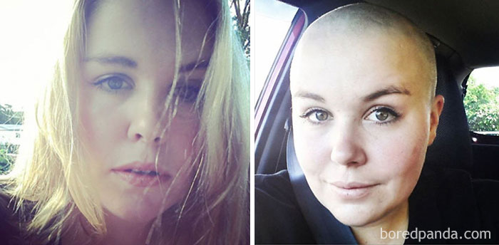 Shaved My Head For The "Shave For A Cure" Fundraiser For Leukaemia & Blood Cancer New Zealand