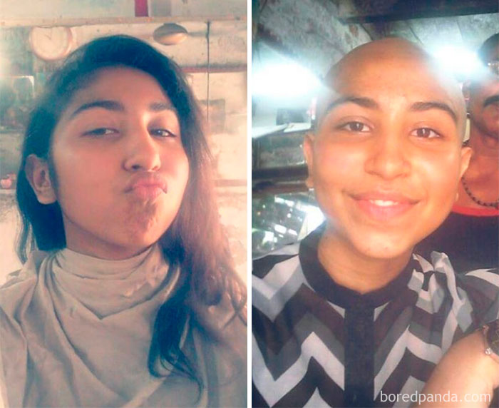 Before And After Getting Your Hair Shaved Off