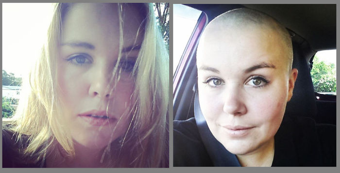 Shaved My Head For The 'shave For A Cure' Fundraiser For Leukaemia & Blood Cancer New Zealand.