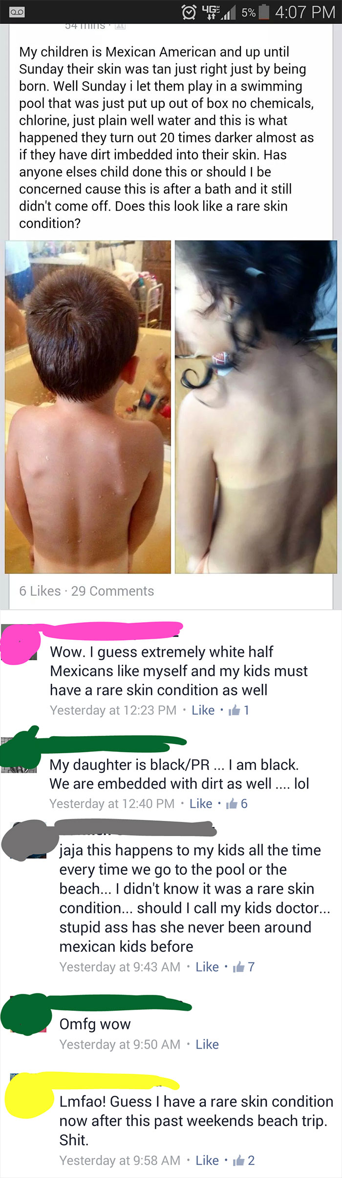 Do My Kids Have A Rare Skin Condition?