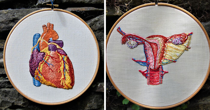 I Started Creating Anatomical Embroidery After I Had An Extensive Facial Surgery