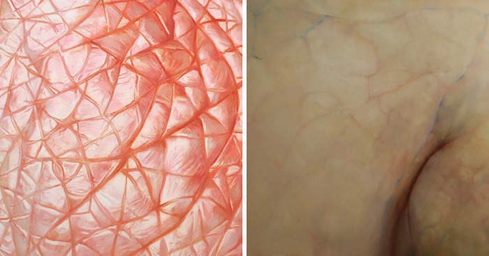 My Hyperrealistic Paintings Of Human Skin
