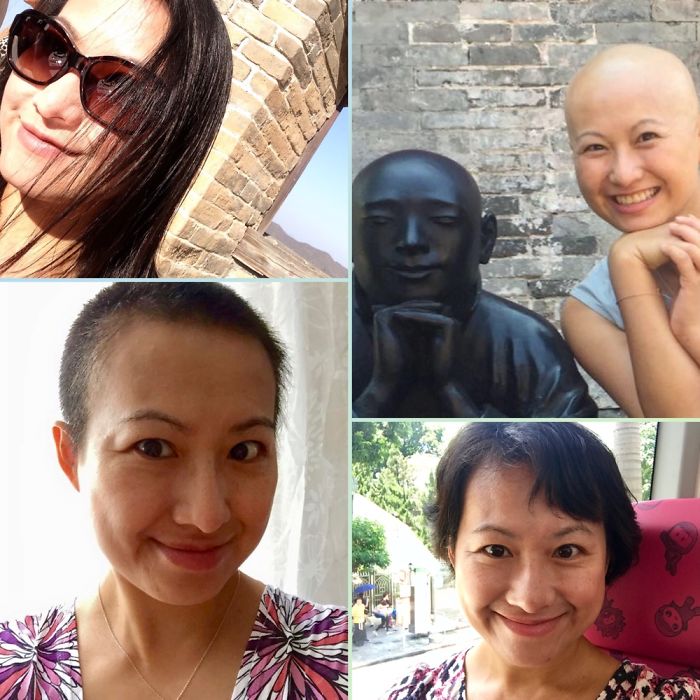 Long... Cut For Surgery... Lost From Chemotherapy... Keep Growing