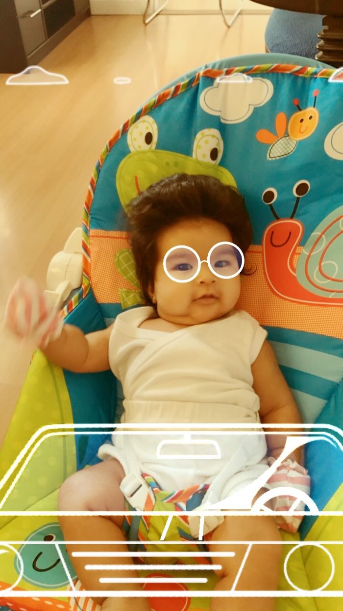 Hairy 2-Month-Old Baby Girl