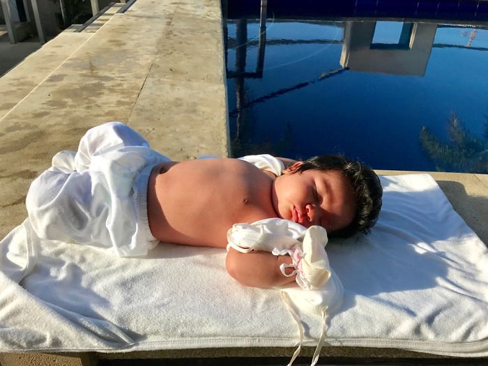 Hairy 2-Month-Old Baby Girl