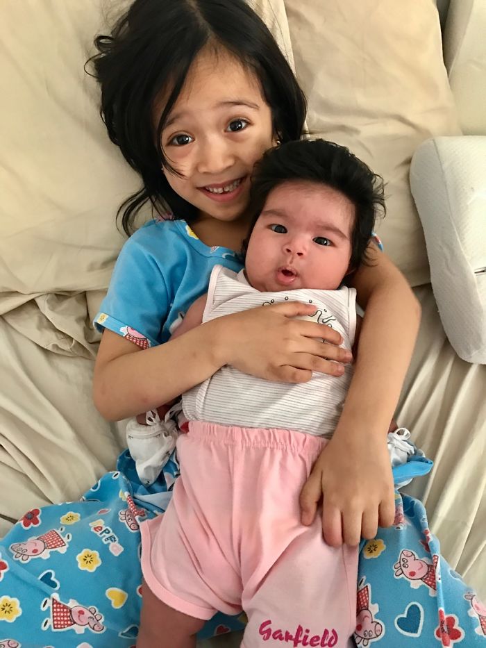 Hairy 2-Month-Old Baby Girl