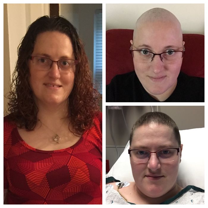 Before, During, And After Chemo And Radiation!!!