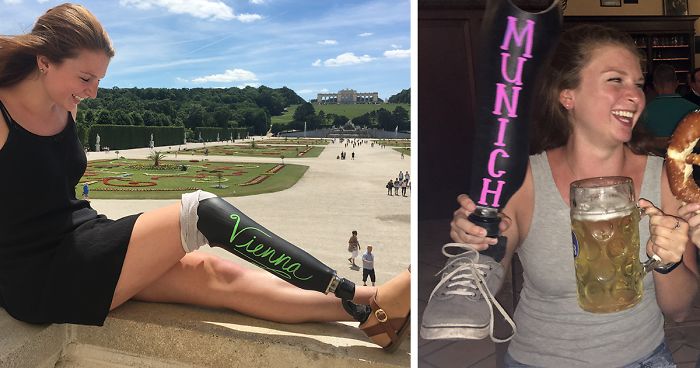 Girl Gets Herself A Chalkboard Leg For A Trip To Europe, And The World Falls In Love With Her