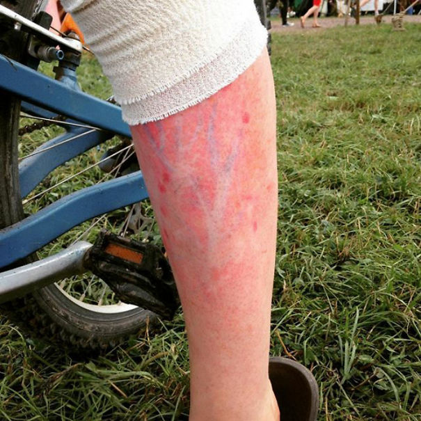 I Couldn't Help But Be Swept Away By The Stunning Cherry Blossom Like Image That Appeared On Her Leg