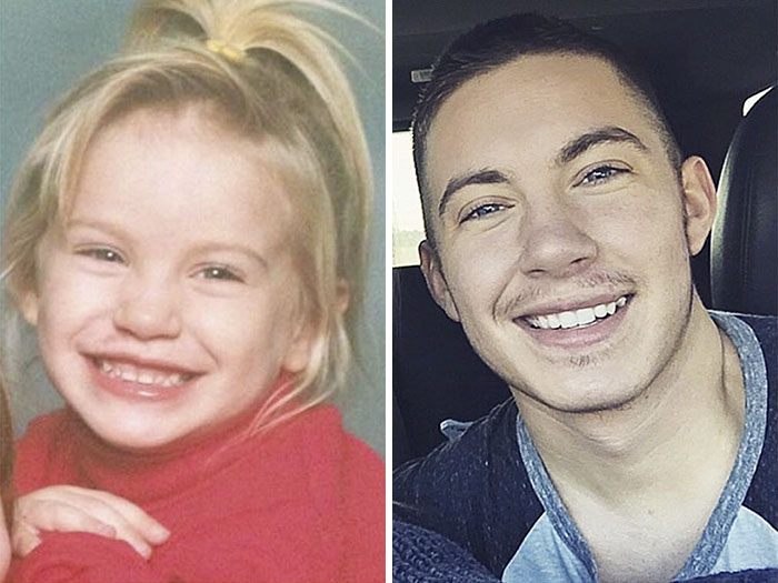 Female-to-male transition photos showing a smiling young girl on the left and a smiling young man on the right. Female-to-male transition photos showing a smiling young girl on the left and a smiling young man on the right.