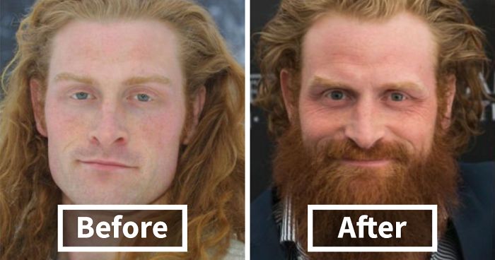 62 Before-And-After Pics That Prove Men Look Better With Beards