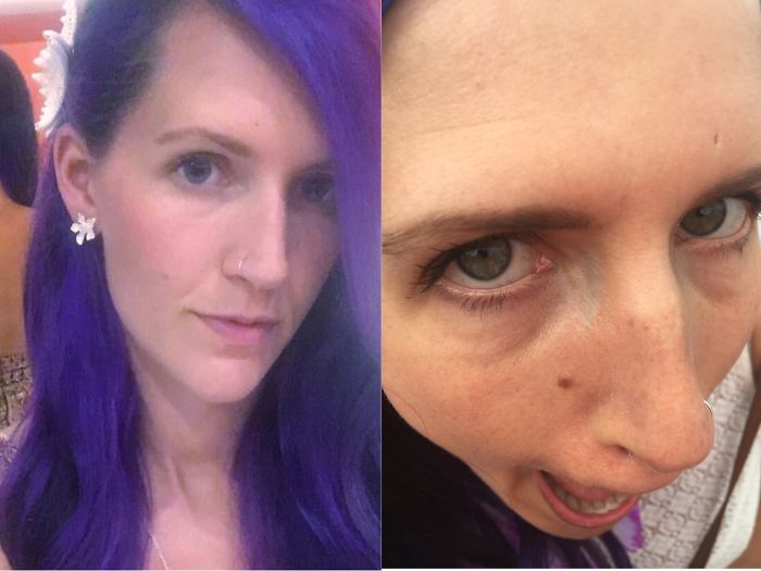 It's All About Angles.