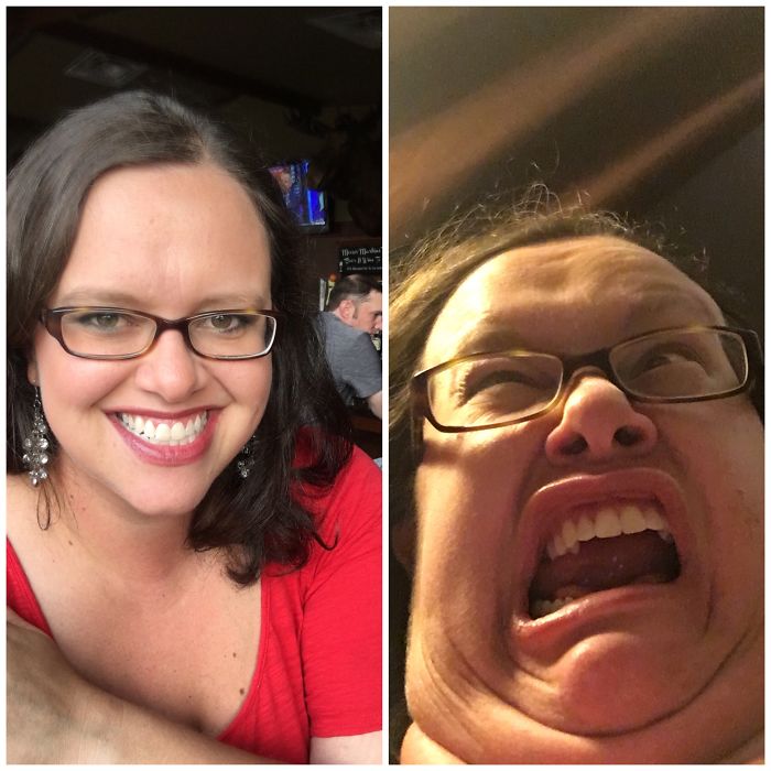 Ugly Before And After 😂