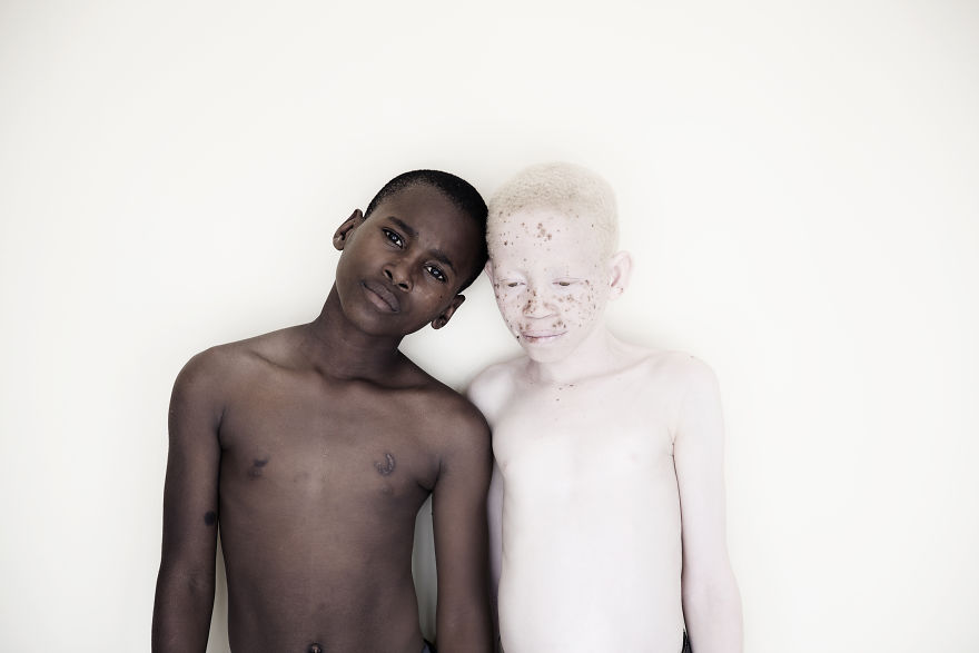 Stunning Photos Show The Beauty Of Albino Children To Raise Awareness Of Their Heartbreaking Situation In Tanzania Stunning Photos Show The Beauty Of Albino Children To Raise Awareness Of Their Heartbreaking Situation In Tanzania