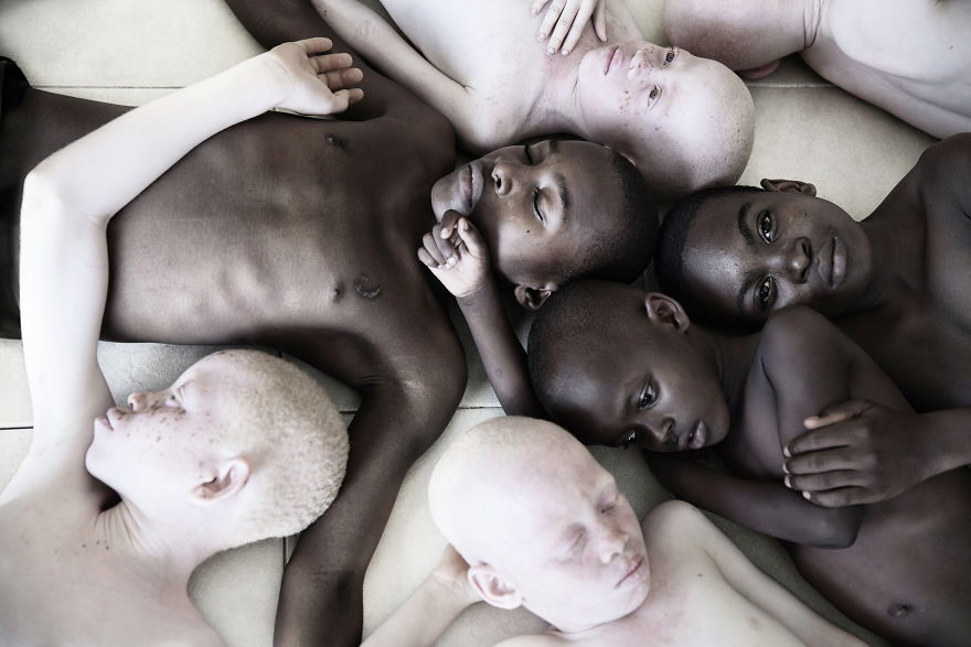 Stunning Photos Show The Beauty Of Albino Children To Raise Awareness Of Their Heartbreaking Situation In Tanzania Stunning Photos Show The Beauty Of Albino Children To Raise Awareness Of Their Heartbreaking Situation In Tanzania